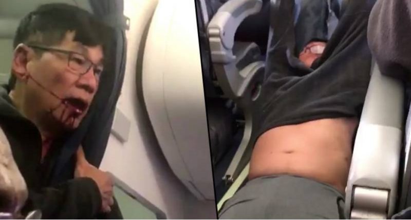 Dr Dao United Airlines